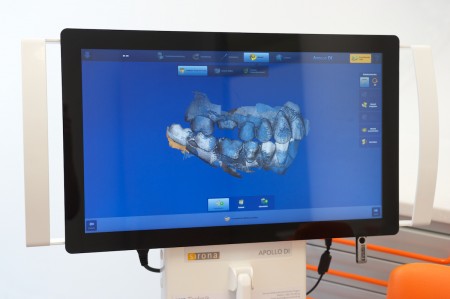 Cerec - abdruckfreier Zahnersatz, Laplace, M-Bogenhausen